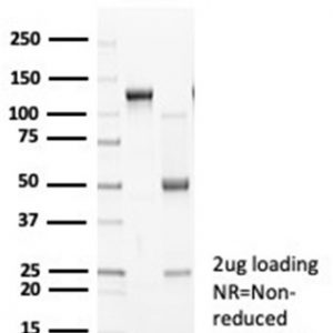 SDS-PAGE Analysis of Purified N-Cadherin Recombinant Rabbit Monoclonal Antibody (CDH2/7070R). Confirmation of Purity and Integrity of Antibody.