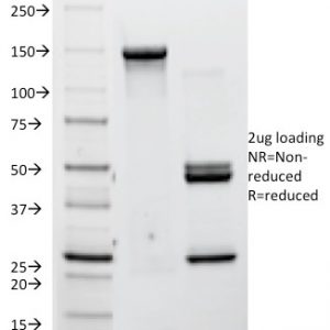 SDS-PAGE Analysis of Purified P-Cadherin Mouse Monoclonal Antibody (12H6). Confirmation of Integrity and Purity of Antibody.