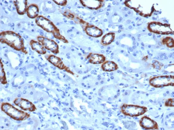 IHC analysis of formalin-fixed, paraffin-embedded human kidney. TOM1L1/4690 at 2ug/ml in PBS for 30min RT. HIER: Tris/EDTA, pH9.0, 45min. 2°C: HRP-polymer, 30min. DAB, 5min.