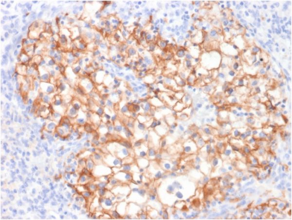 CDH16 Antibody in Immunohistochemistry (IHC (P))