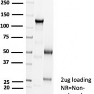SDS-PAGE Analysis of Purified CDH16 Rabbit Recombinant Monoclonal Antibody (CDH16/7027R). Confirmation of Purity and Integrity of Antibody.