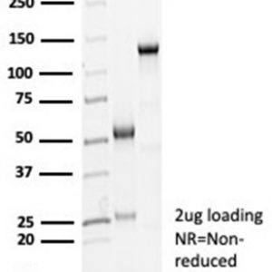 SDS-PAGE Analysis of Purified CDH16 Rabbit Recombinant Monoclonal Antibody (CDH16/7028R). Confirmation of Purity and Integrity of Antibody.