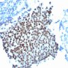 p21WAF1 (Tumor Suppressor Protein) Antibody