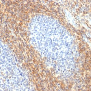 Formalin-fixed, paraffin-embedded human Tonsil stained with CD52 Rabbit Recombinant Monoclonal Antibody (CD52/2276R).