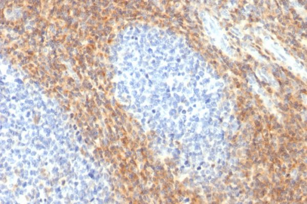 Formalin-fixed, paraffin-embedded human Tonsil stained with CD52 Rabbit Recombinant Monoclonal Antibody (CD52/2276R).