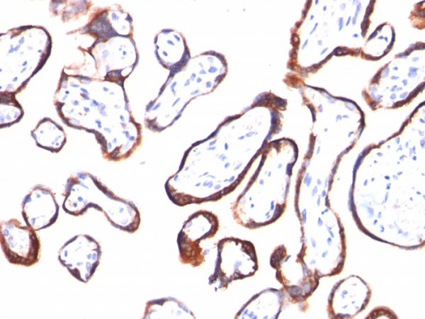 Formalin-fixed, paraffin-embedded human Placenta stained with hCG beta Mouse Monoclonal Antibody (HCGb/54).