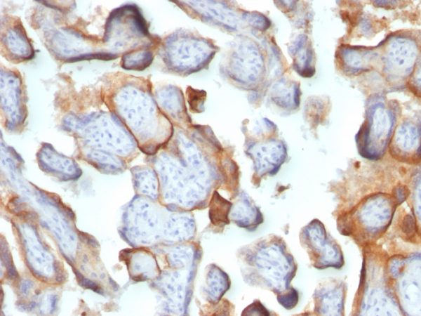 Formalin-fixed, paraffin-embedded human Placenta stained with hCG beta Monoclonal Antibody (SPM105).