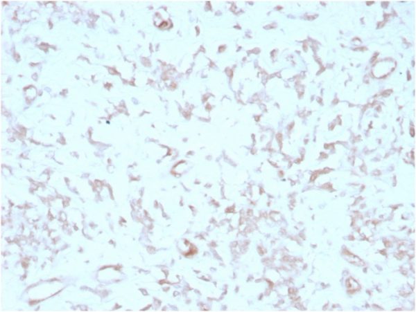 Formalin-fixed, paraffin-embedded human liver stained with KIND2 Mouse Monoclonal Antibody (3A3).
