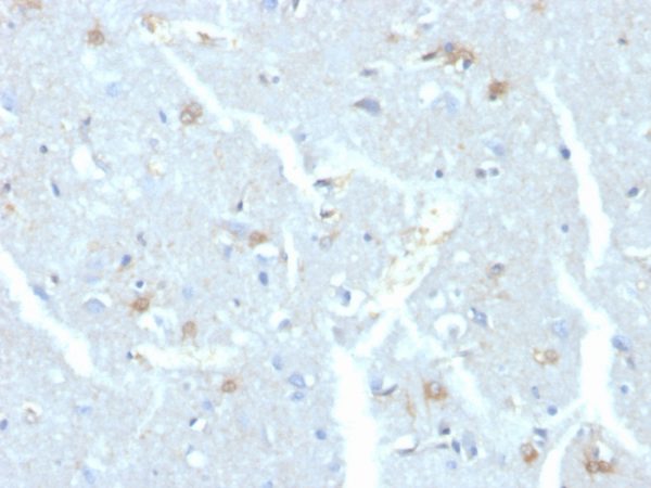 Formalin-fixed, paraffin-embedded human brain stained with UBE2C Mouse Monoclonal Antibody (CPTC-UBE2C-1)