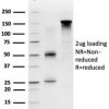 ECD/ SGT1 Antibody