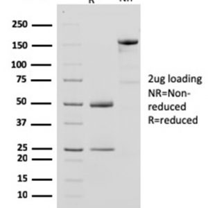 SDS-PAGE Analysis of Purified CKBB Mouse Monoclonal Antibody (CPTC-CKB-2). Confirmation of Purity and Integrity of Antibody.