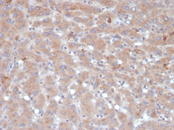 Formalin-fixed, paraffin-embedded human liver stained with Alpha-1-Antichymotrypsin Mouse Monoclonal Antibody (SERPINA3/4189).