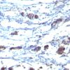 CD195 (CC-Chemokine Receptor 5) Antibody