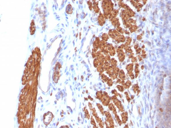 Formalin-fixed, paraffin-embedded Rat Uterus stained with Calponin-1 Mouse Monoclonal Antibody (CNN1/832).