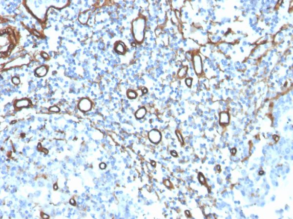 Formalin-fixed, paraffin-embedded human tonsil stained with Collagen IV Recombinant Rabbit Monoclonal Antibody (COL4/4241R).