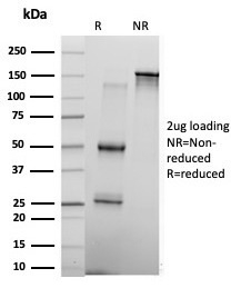 SDS-PAGE Analysis of Purified KLF17 Mouse Monoclonal Antibody (PCRP-KLF17-1G2). Confirmation of Purity and Integrity of Antibody.
