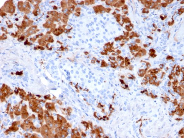 Formalin-fixed, paraffin-embedded human Pancreas stained with Carboxypeptidase A1 / CPA1 Mouse Monoclonal Antibody (CPA1/2712).