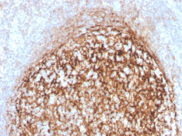 Formalin-fixed, paraffin-embedded human tonsil stained with CD35 Recombinant Rabbit Monoclonal Antibody (CR1/4382R).