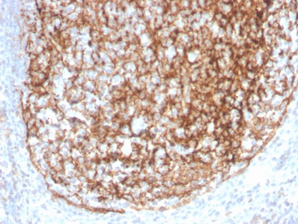 Formalin-fixed, paraffin-embedded human tonsil stained with CD35 Recombinant Rabbit Monoclonal Antibody (CR1/4382R).