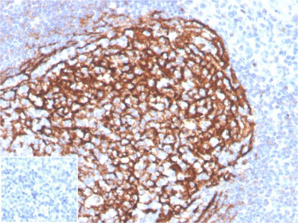 Formalin-fixed, paraffin-embedded human tonsil stained with CD21 Recombinant Rabbit Monoclonal Antibody (CR2/3990R). Inset: PBS instead of primary antibody; secondary only negative control.