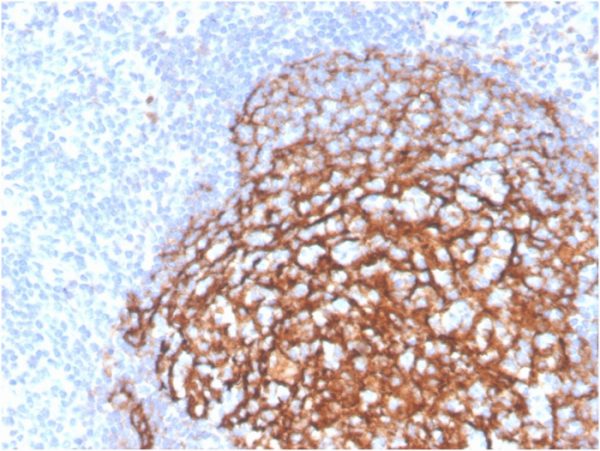 Formalin-fixed, paraffin-embedded human tonsil stained with CD21 Recombinant Rabbit Monoclonal Antibody (CR2/3990R).