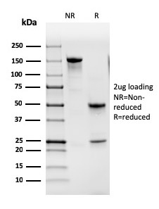 SDS-PAGE Analysis of Purified GM-CSF Mouse Monoclonal Antibody (CSF2/3402). Confirmation of Purity and Integrity of Antibody.