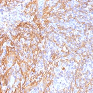 Formalin-fixed, paraffin-embedded human Tonsil stained with Beta-Catenin (p120) Monoclonal Antibody (6F9).