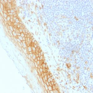 Formalin-fixed, paraffin-embedded human Tonsil stained with Beta-Catenin (p120) Monoclonal Antibody (CTNNB1/1509).