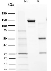 SDS-PAGE Analysis of Purified Cytochrome P450 1A1/1A2 Mouse Monoclonal Antibody (MC1). Confirmation of Purity and Integrity of Antibody.