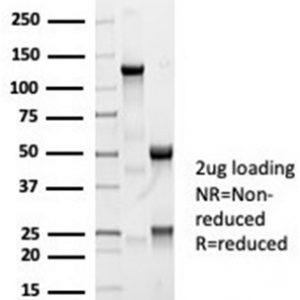 SDS-PAGE Analysis of Purified ACE / CD143 Rabbit Monoclonal Antibody (ACE/7004R). Confirmation of Integrity and Purity of Antibody.