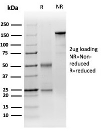 SDS-PAGE Analysis of Purified DCP2 Mouse Monoclonal Antibody (PCRP-DCP2-1D6). Confirmation of Purity and Integrity of Antibody.