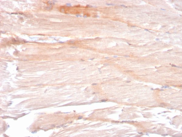 Formalin-fixed, paraffin-embedded human skeletal muscle stained with Dystrophin Monospecific Mouse Monoclonal Antibody (DMD/3241).