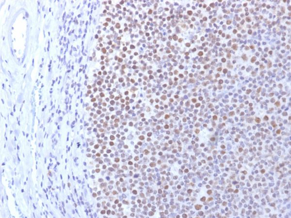 Formalin-fixed, paraffin-embedded human Tonsil stained with DNMT1 Mouse Monoclonal Antibody (DNMT1/2061).