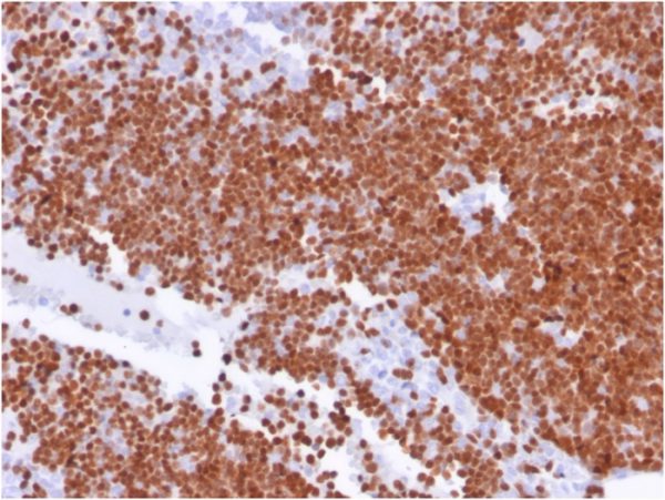 Formalin-fixed, paraffin-embedded human thymus stained with TdT Monospecific Mouse Monoclonal Antibody (TDT/1393).