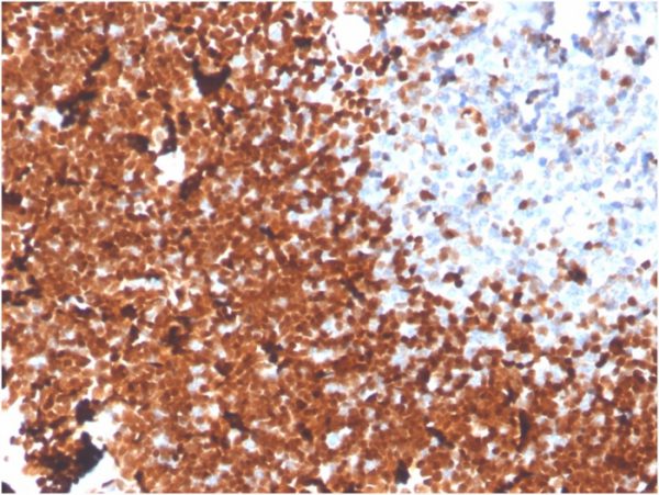 Formalin-fixed, paraffin-embedded human Thymus stained with TdTMouse Monoclonal Antibody (DNTT/1453).