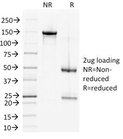 SDS-PAGE Analysis of Purified DSG2 Mouse Monoclonal Antibody (6D8). Confirmation of Integrity and Purity of Antibody.