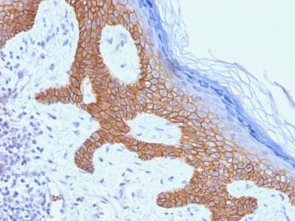 Formalin-fixed, paraffin-embedded human Skin stained with Desmoglein-3 Monoclonal Antibody (DSG3/1535).