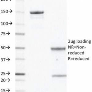 EGFR Antibody in SDS-PAGE