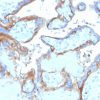 EGFR (Epidermal Growth Factor Receptor) Antibody
