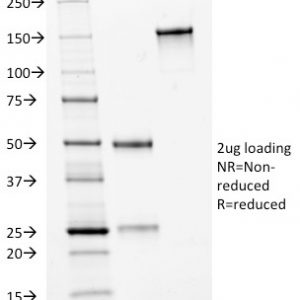 SDS-PAGE Analysis of Purified HER-2 Mouse Monoclonal Antibody (HRB2/282). Confirmation of Integrity and Purity of Antibody.