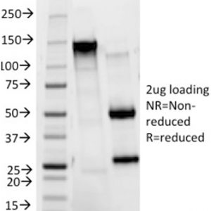 SDS-PAGE Analysis of Purified HER-2 Mouse Monoclonal Antibody (HRB2/273). Confirmation of Integrity and Purity of Antibody.