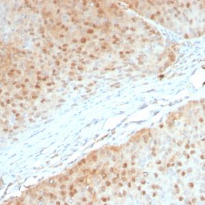 Formalin-fixed, paraffin-embedded human Pancreas stained with AKT1 Mouse Monoclonal Antibody (AKT1/2552).