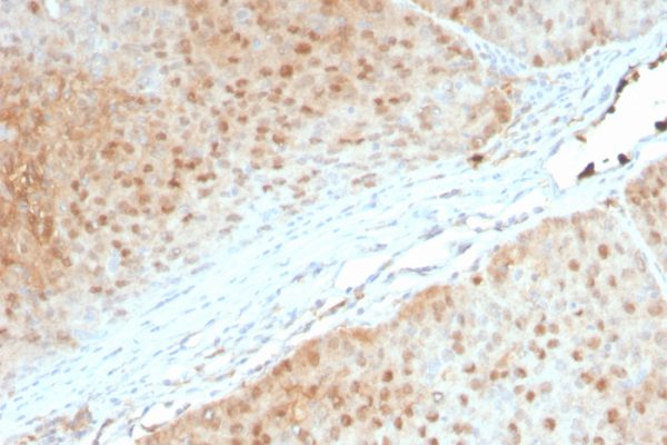 Formalin-fixed, paraffin-embedded human Pancreas stained with AKT1 Mouse Monoclonal Antibody (AKT1/2552).