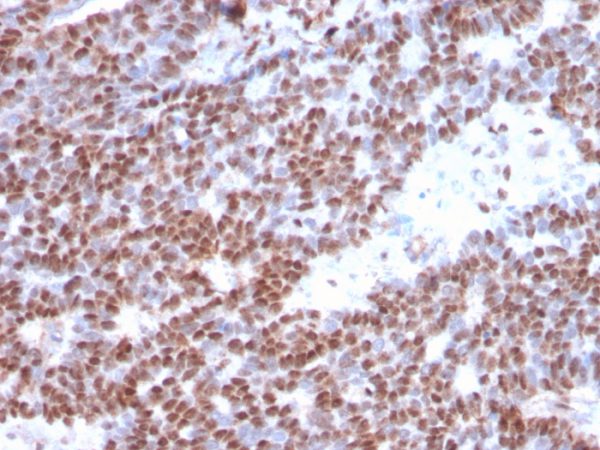 Estrogen Receptor Antibody in Immunohistochemistry (IHC (P)).