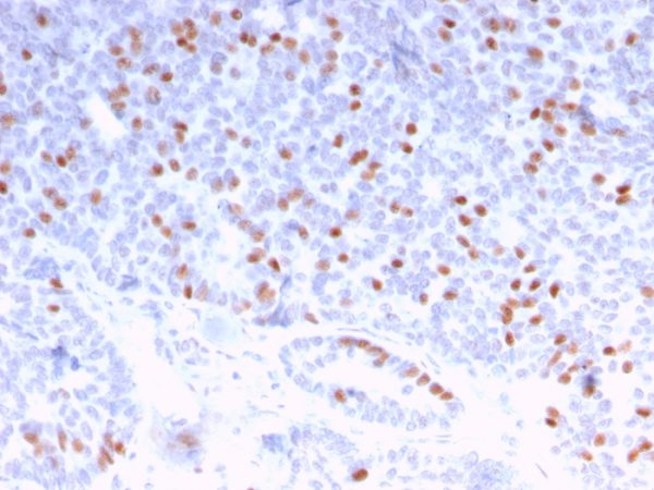 Estrogen Receptor Antibody in Immunohistochemistry (IHC (P)).