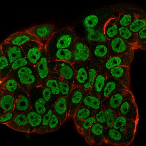 Immunofluorescence staining of MCF-7 cells using Estrogen Receptor alpha Mouse Monoclonal Antibody (ESR1/3557) followed by goat anti-Mouse IgG-CF488 (green). Membrane stained with Phalloidin (red).