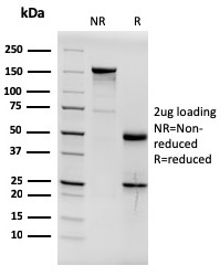 SDS-PAGE Analysis of Purified Estrogen Receptor alpha Mouse Monoclonal Antibody (ESR1/3564). Confirmation of Integrity and Purity of Antibody.