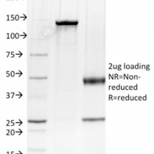 Albumin in SDS-PAGE