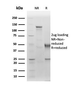 SDS-PAGE Analysis of Purified Albumin Recombinant Rabbit Monoclonal Antibody (ALB/6411R). Confirmation of Purity and Integrity of Antibody.
