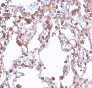 Formalin-fixed, paraffin-embedded human lung stained with ALDH1A1 Recombinant Mouse Monoclonal Antibody (rALDH1A1/7285). HIER: Tris/EDTA, pH9.0, 45min. 2 °: HRP-polymer, 30min. DAB, 5min.